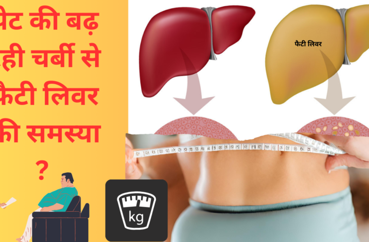 Belly fat kaise kam kare